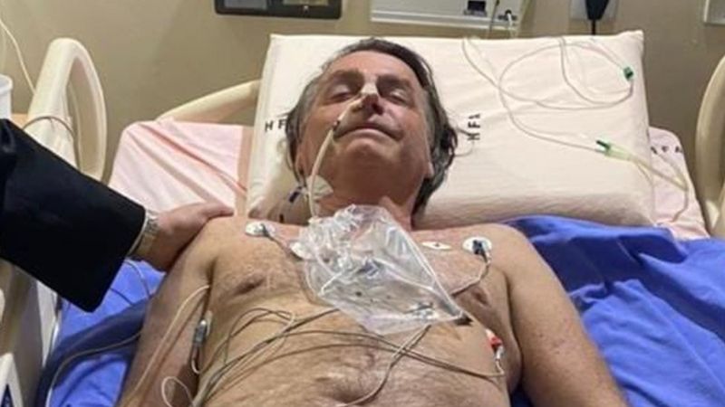 Jair Bolsonaro: presidente de Brasil sigue en el hospital tras ingresar por hipo crónico y serle diagnosticada obstrucción intestinal